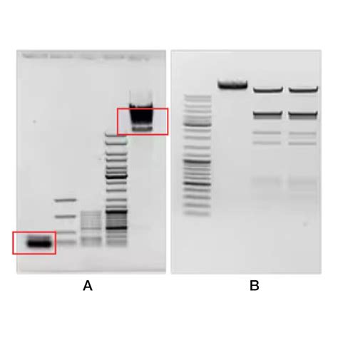how to improve gel electrophoresis results|Gel electrophoresis (article) .
